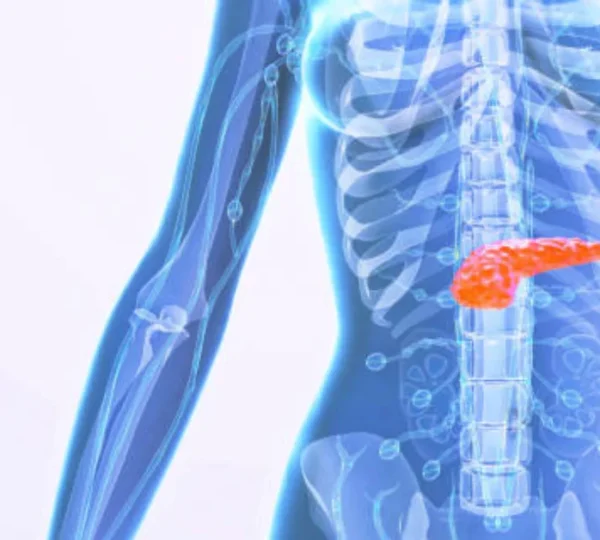 Can You Live Without a Gallbladder?